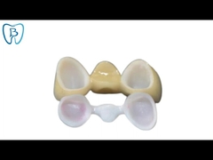 PFM Co Cr 3014652903 Ceramic Dental Bridge Custom Colour Stability
