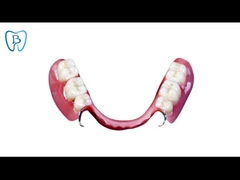 Removable Dental Partial Denture Natural Color 3D Dental Model Customized
