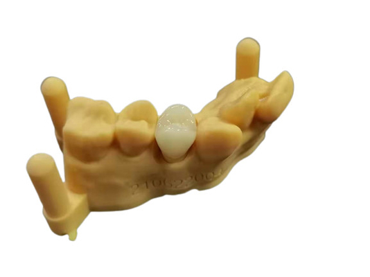 OEM 3D che stampa progettazione dentaria di Digital del laboratorio della protesi dentaria acrilica flessibile