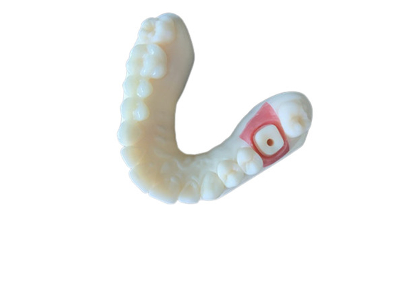 L'alto dente della corona di biossido di zirconio della stabilità PFM macchia resistente per la ricerca