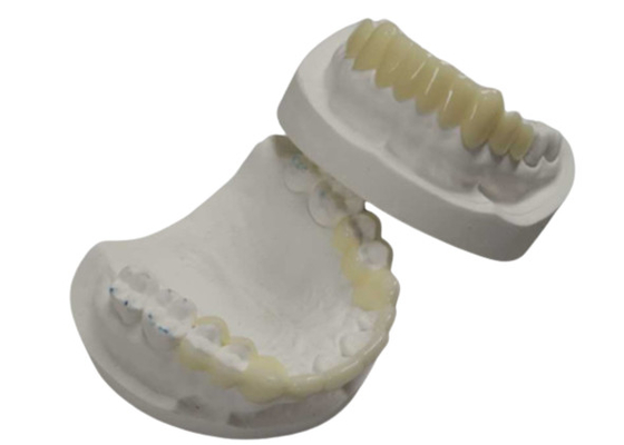 Stampa CAD CAM 3D ad alta durabilità Corone temporanee Resina durevole