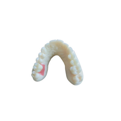 Scansione orale digitale PFM Corone dentali Richieste di implantologia del ponte