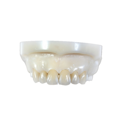 Corone e ponti dentali in zirconia completamente in ceramica