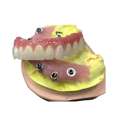 Corona dentaria di biossido di zirconio dell'appoggio dell'impianto naturale interamente su quattro protesi dentarie