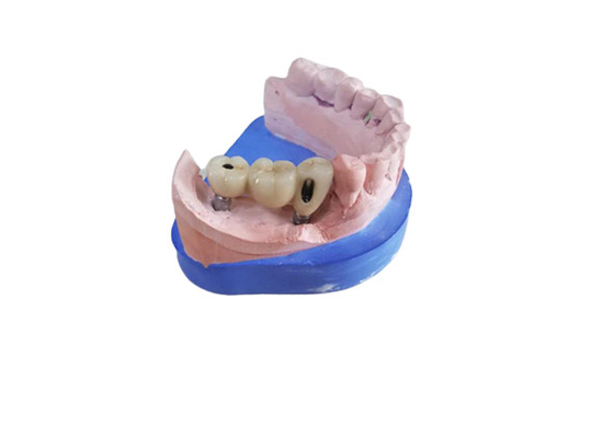Corona dentaria di biossido di zirconio di camma di cad con l'appoggio basso di titanio di biossido di zirconio