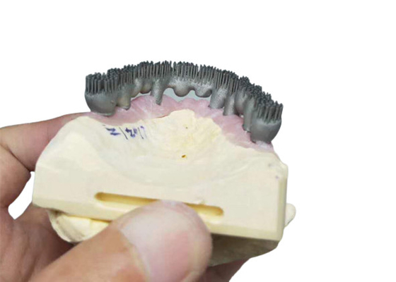 Stampatore durevole Dental Lab Prints di camma PFM 3D di cad per ricerca