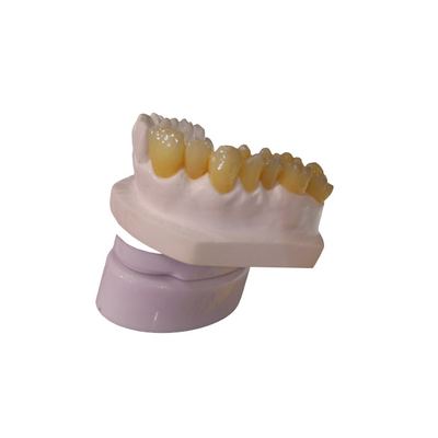 Stampatore dentario Dental Crowns del laboratorio 3D della corona di progettazione PFM di camma di cad