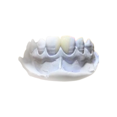 Materiali dentari smontabili di salute della corona della resina efficiente PFM