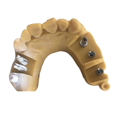 Corona dentaria 3D di biocompatibilità PFM di Digital che stampa le corone temporanee