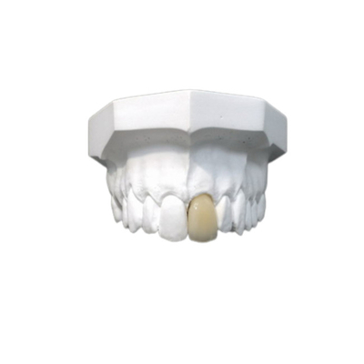 Materiale biologico alta tecnologia della buona di biocompatibilità corona dentaria della porcellana