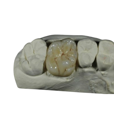 Corona dentaria della porcellana flessibile di iso del CE per ripristino dei denti posteriori