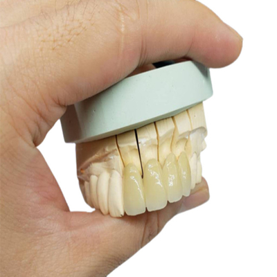 Corona resistente alla corrosione della porcellana dell'OEM di sicurezza tutto lo sguardo naturale ceramico