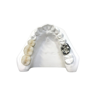 Alta densità dentaria di sicurezza di salute della corona della porcellana ultra dura di Digital