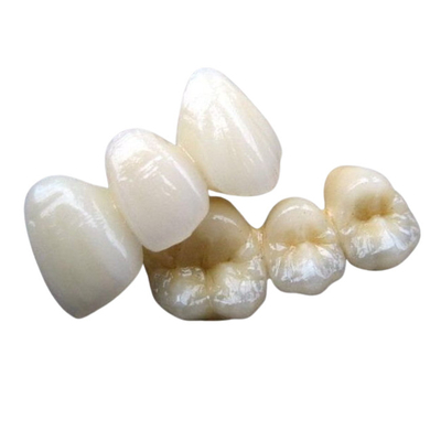 Stabilità di colore su ordinazione del ponte dentario ceramico del Cr 3014652903 di PFM Co