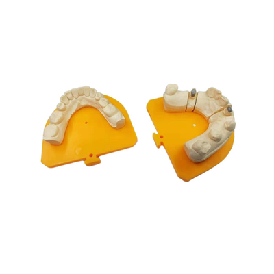Corona ceramica dentaria della corona PFM della porcellana ad alta resistenza dell'oro giallo