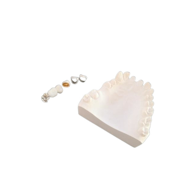 Resistenza della corrosione completa su misura del metallo della corona dentaria della porcellana di PFM