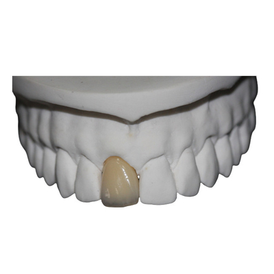 Corona dentaria della porcellana del Cr di Co