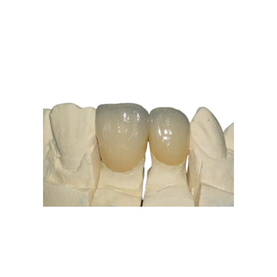 Corona metal-ceramica di superficie liscia di PFM resistente alla corrosione