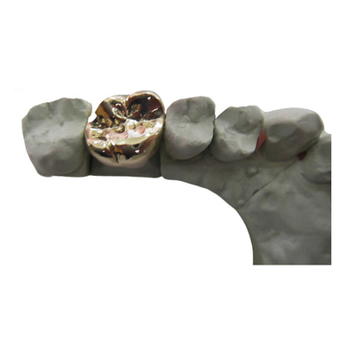 Materiale biologico alta tecnologia del metallo PFM del ponte dentario pieno della corona
