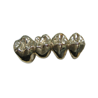 Colata facile dentaria preziosa del ponte PFM della corona degli alti semi di stabilità