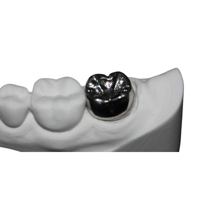 Ponte dentario naturale della corona di FDA di stabilità di colore resistente alla corrosione