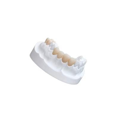 Impiallacciature composite della porcellana di IPS E Max Ceramic Dental Crown Comfortable