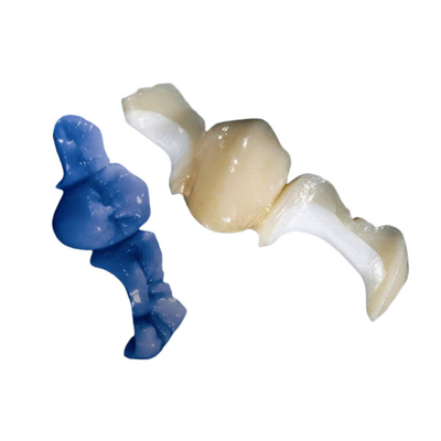 OEM su misura che lucida il parte sovrapposto in rilievo dentario Tutto ceramico dell'intarsio dell'impiallacciatura della corona