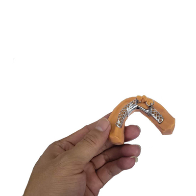 3D che stampa i modelli dentari smontabili della struttura della corona per odontoiatria