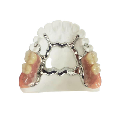 Natrural protegge 3D che stampa la protesi dentaria smontabile fissa per il dentista Study