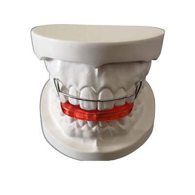 L'ortodonzia su ordinazione del posizionatore del dente dell'OEM semplice installa facile mantiene