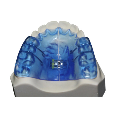 Strumenti dentari ortopedici con alta stabilità e la buona biocompatibilità