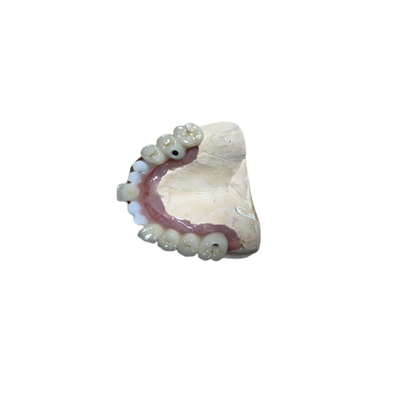 Corona accurata dell'impianto del dente dei collegamenti dell'impianto dentario di biocompatibilità