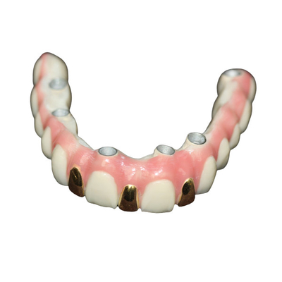 Precisione Digital 3D che stampa il metallo di Antivari dell'impianto dentario basato