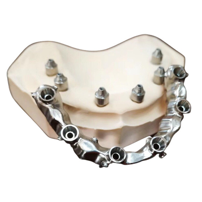 FDA 3014652903 forti altamente estetici dentari del ponte di PFM estremamente