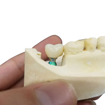 Apprendimento continuo istruendo la Comunità dentaria