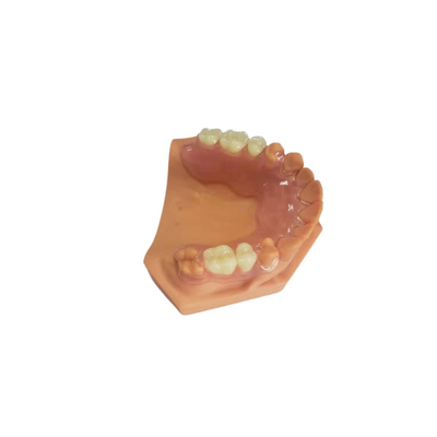 3D ha stampato le protesi dentarie per i laboratori dentari basati sui dati di Digital