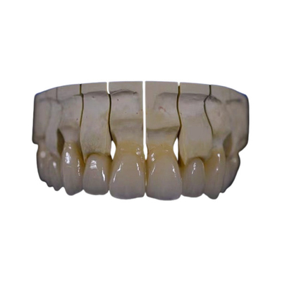 Il biossido di zirconio dentario di ripristino della corona di biossido di zirconio pieno della bocca ha riparato la resistenza chimica del ponte