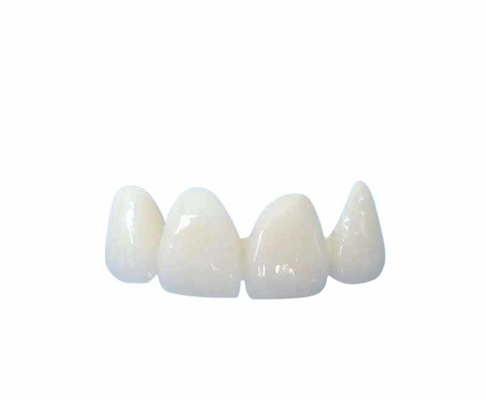 Facile pulendo tutto il ceramico incorona la tonalità naturale trasparente personalizzabile