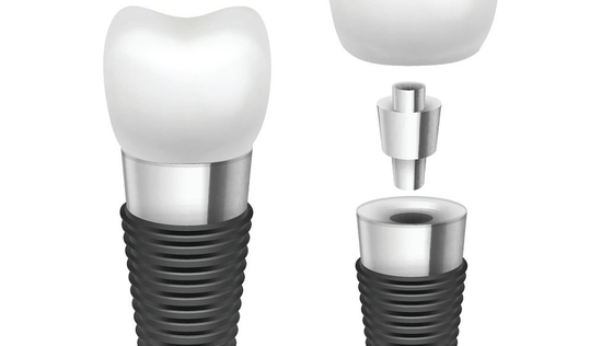 Impianto dentario Rod Comfortable Highly Biocompatible Implant del cromo cobalto/del titanio
