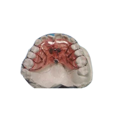 Ganci ortodontici fissi smontabili di pulizia facili dei Aligners fissi sicuri