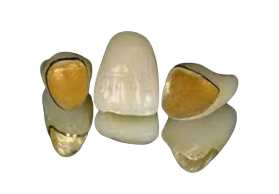 Progettazione realistica di digitalizzazione di colore di PFM del metallo dei denti di superficie lisci della porcellana