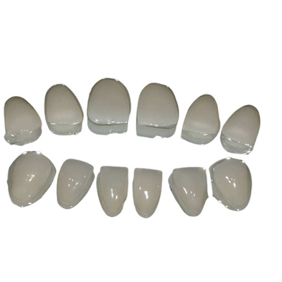 Pulizia facile dei denti ceramici dell'impiallacciatura di personalizzazione per il sorriso sicuro