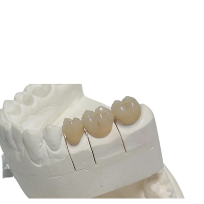 Corona dentaria temporanea 3D camma/di cad PFM che stampa personalizzazione della protesi dentaria di progettazione