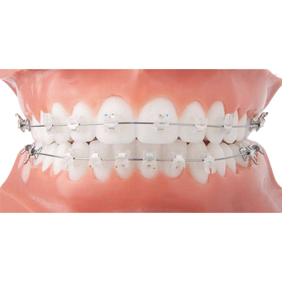 Bei apparecchi ortodontici fissi del sostegno ceramico ortodontico pulito facile
