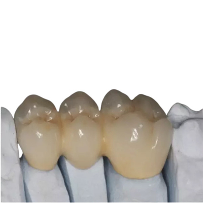 L'OEM ha personalizzato il bene durevole ad alta resistenza dei denti della porcellana di biossido di zirconio bello