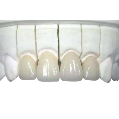 3D ha stampato biocompatibile resistente all'uso della corona dentaria di biossido di zirconio altamente