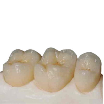 Precisione ceramica Digital dei denti di biossido di zirconio ad alta resistenza fabbricata