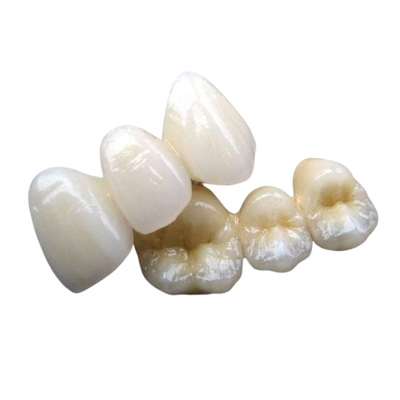 Stabilità del dente della corona del ponte della porcellana forte nessuno sensazione del corpo estraneo