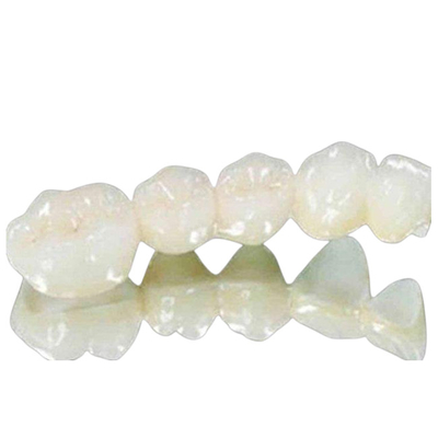 Biossido di zirconio dentario altamente biocompatibile del ponte della corona tutta la buona forza del ponte ceramico