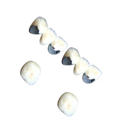 Denti dentari della porcellana di Chrome del cobalto della corona della porcellana non allergica resistenti alla corrosione